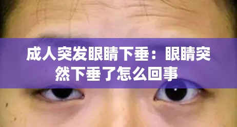 成人突發眼睛下垂：眼睛突然下垂了怎么回事 