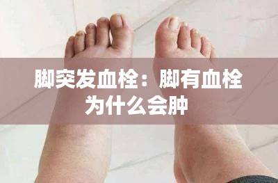腳突發血栓：腳有血栓為什么會腫 
