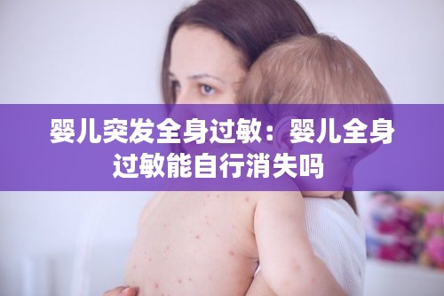嬰兒突發全身過敏：嬰兒全身過敏能自行消失嗎 