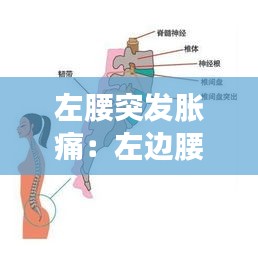 左腰突發脹痛：左邊腰突出腰疼怎么辦 