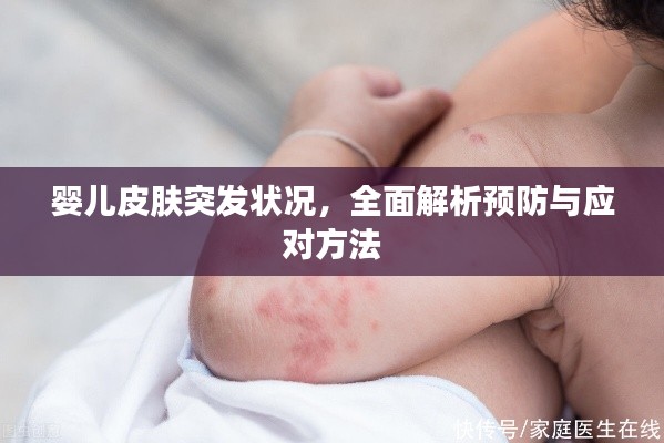 嬰兒皮膚突發狀況，全面解析預防與應對方法