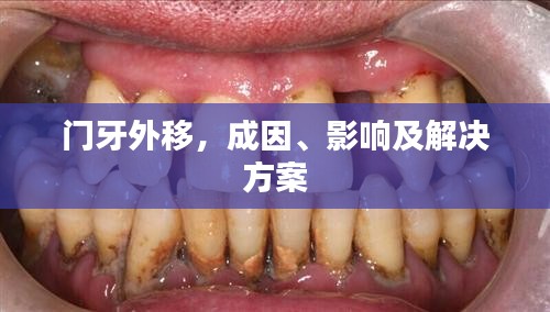 門牙外移，成因、影響及解決方案