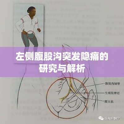 左側(cè)腹股溝突發(fā)隱痛的研究與解析