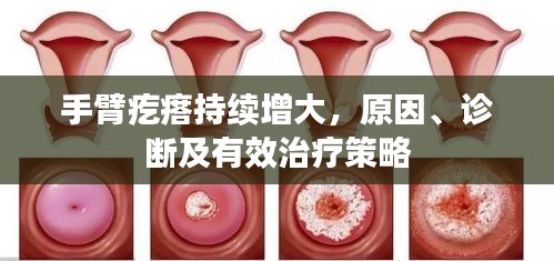 手臂疙瘩持續(xù)增大，原因、診斷及有效治療策略