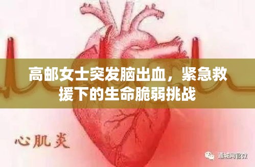 高郵女士突發腦出血，緊急救援下的生命脆弱挑戰