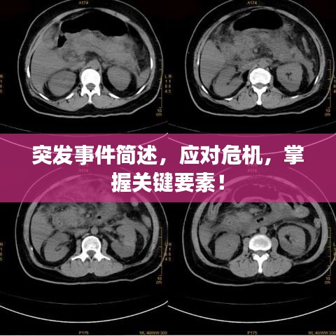 突發事件簡述，應對危機，掌握關鍵要素！