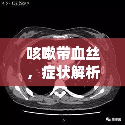 咳嗽帶血絲，癥狀解析、誘因探究及有效治療策略